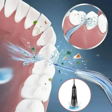 Irrigateur Buccal Portable - OralJet