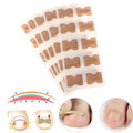 Kit de 100 Patchs Correcteurs pour Ongle Incarné