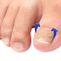 Kit de 100 Patchs Correcteurs pour Ongle Incarné